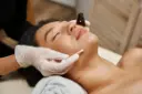 Acne Facial