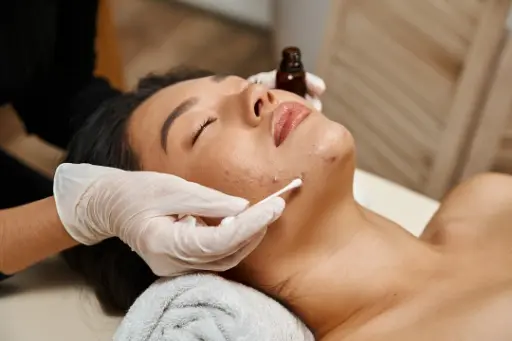Acne Facial